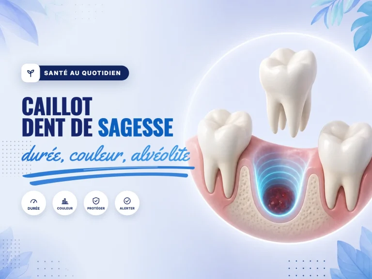 caillot de sang dans l'alvéole après une extraction de dent de sagesse
