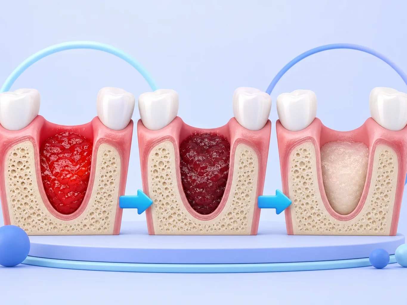 évolution de la couleur normale d'un caillot de sang dentaire au fil des jours