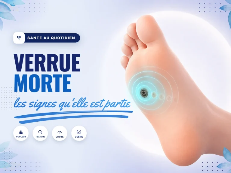 à quoi ressemble une verrue morte sur un pied